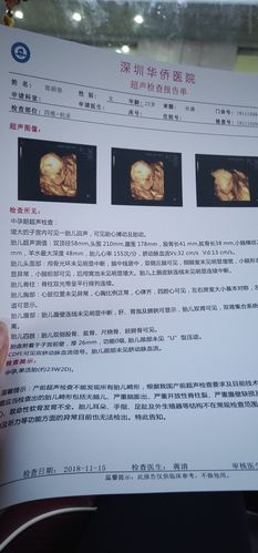 包生男孩机构怎么找【如何找到包生男孩机构】